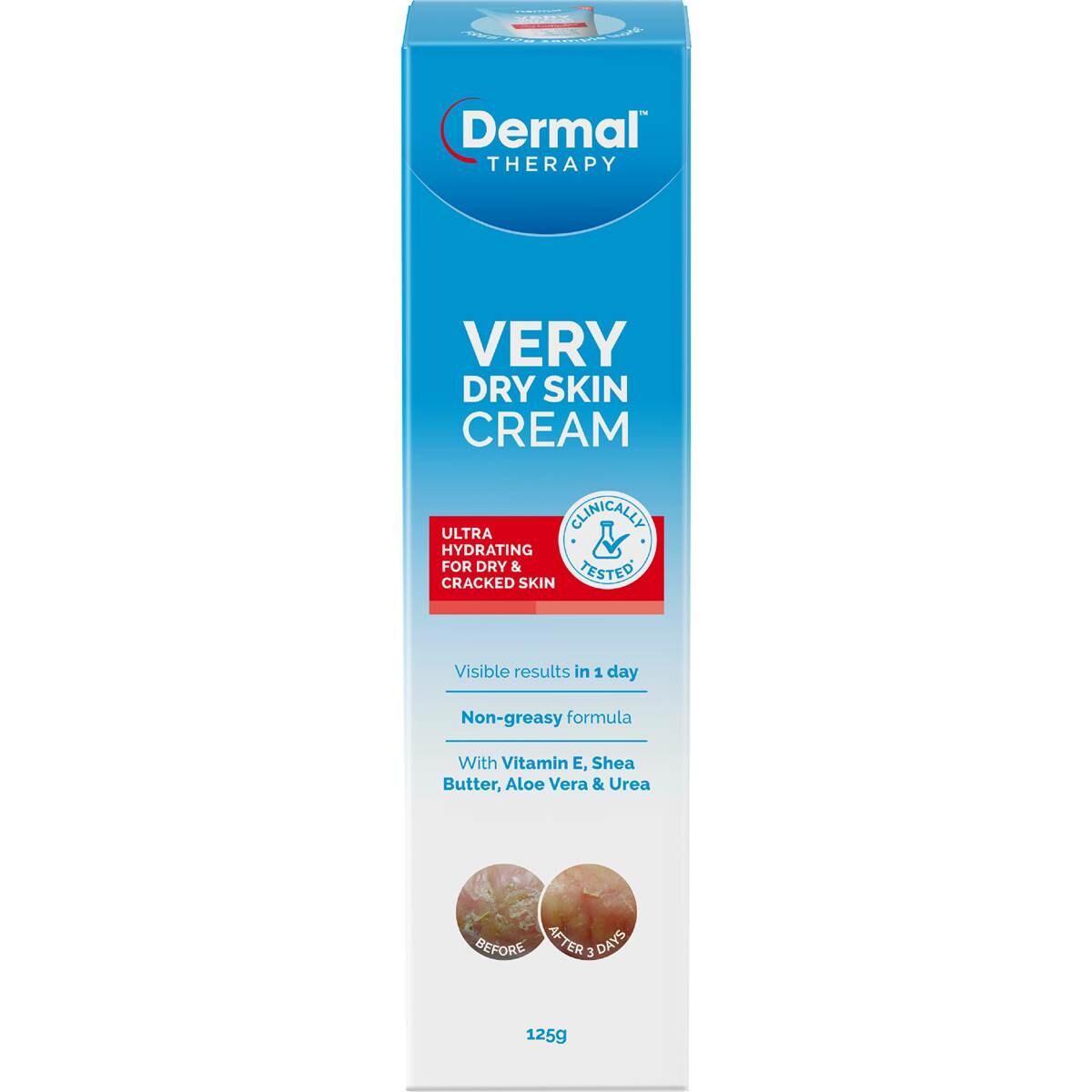 Dermal Therapy Very Dry Skin Cream 125g
