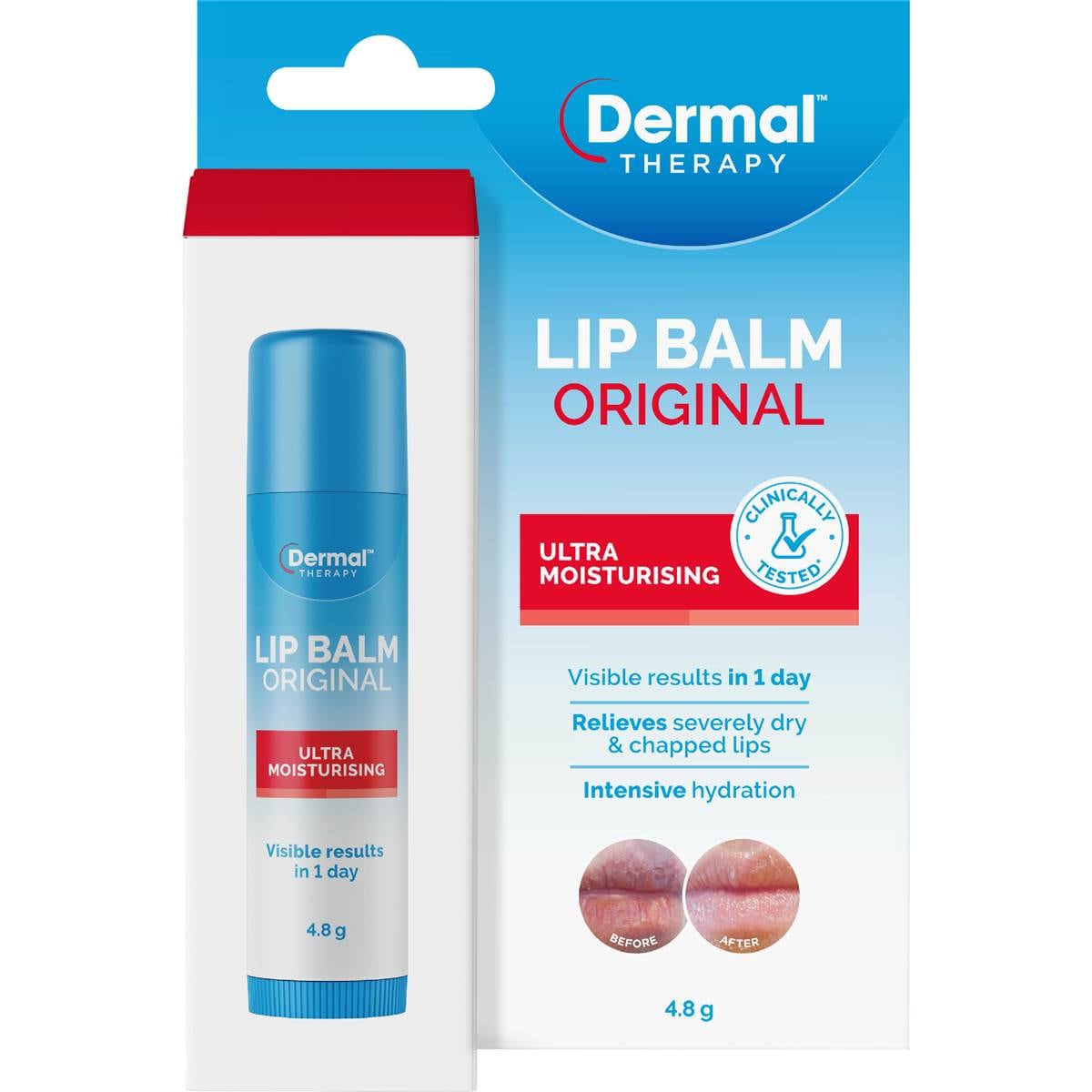 Dermal Therapy Lip Balm Ultra Moisturising Stick 4.8g